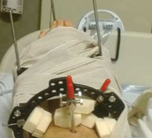 Jacob’s ankle during treatment